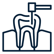 endodoncia